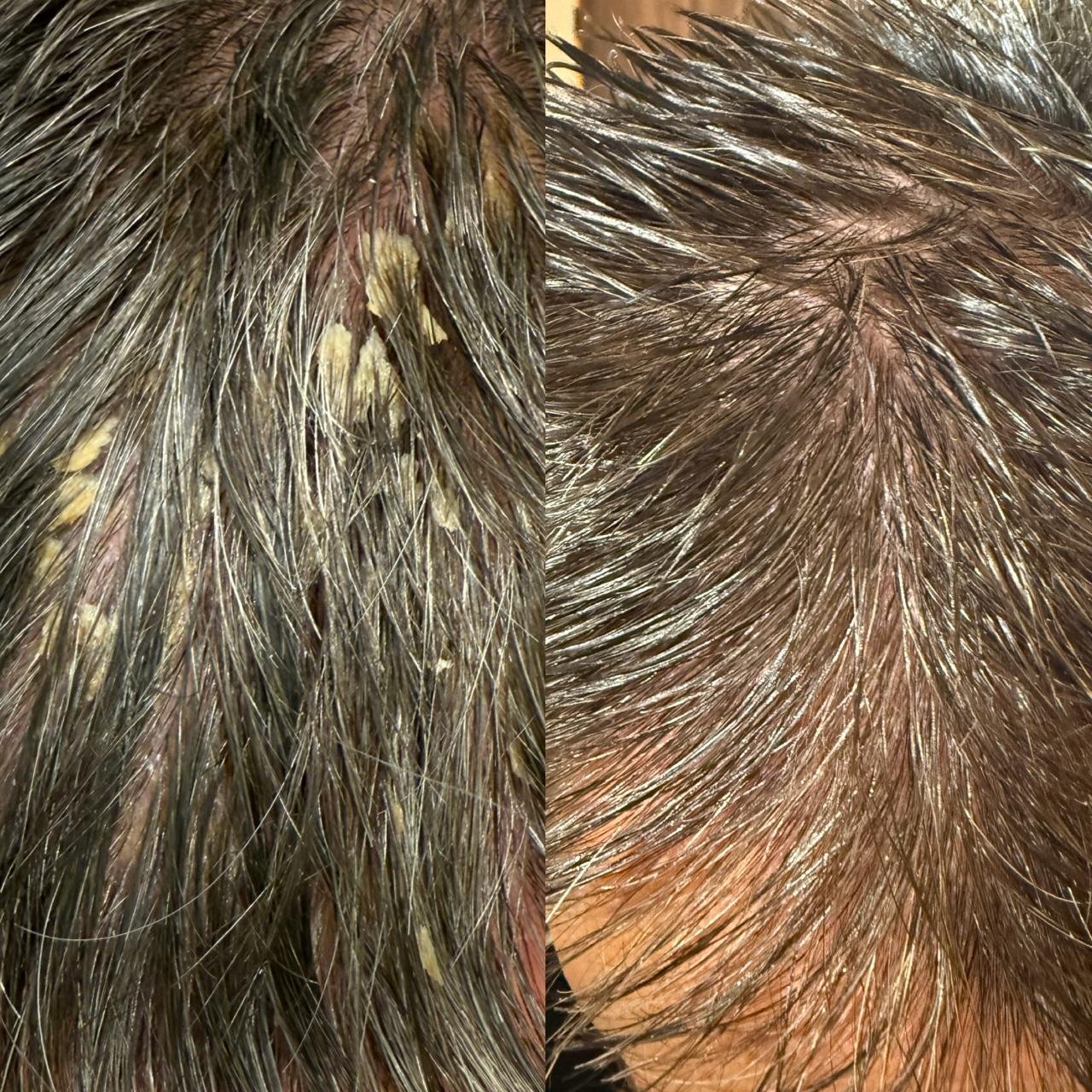 Before and after Scalp Repair hair treatment