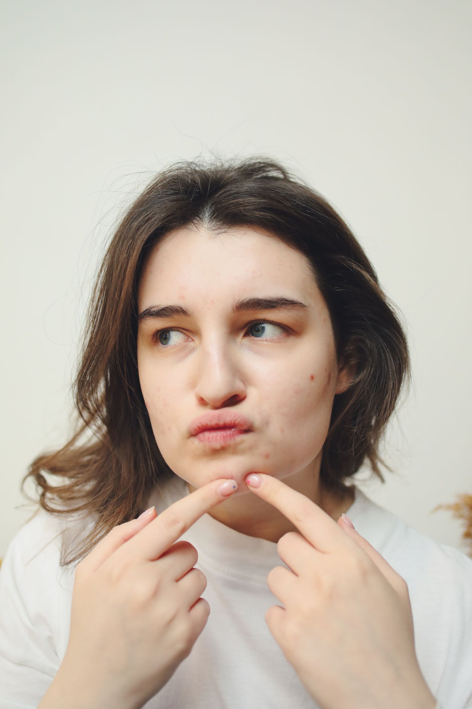 Acnipure facial treatment in Abu Dhabi