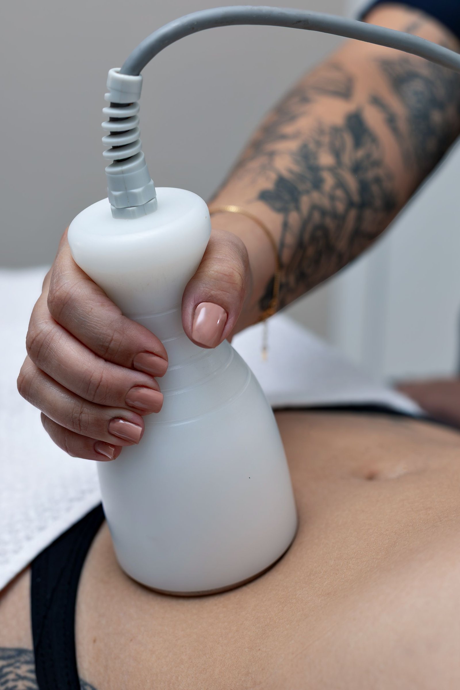 Radiofrequency Skin Tightening treatment in Abu Dhabi